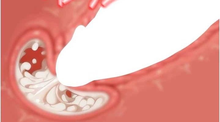 第89张