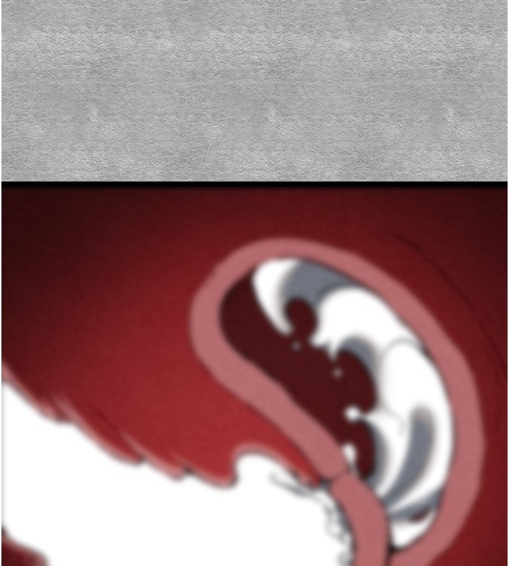 第158张