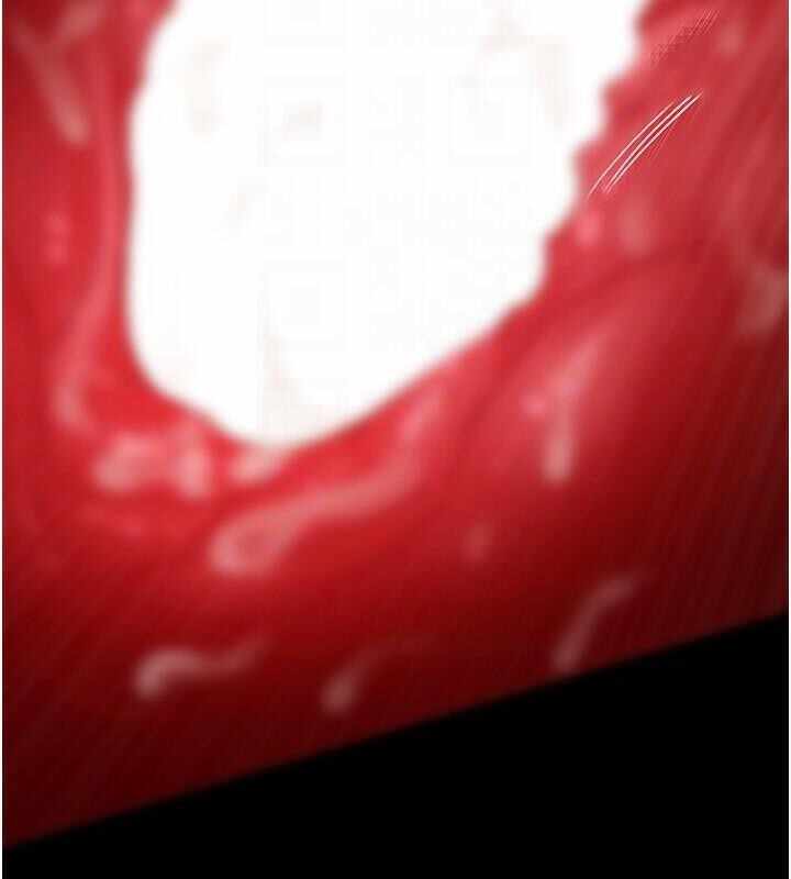 第160张